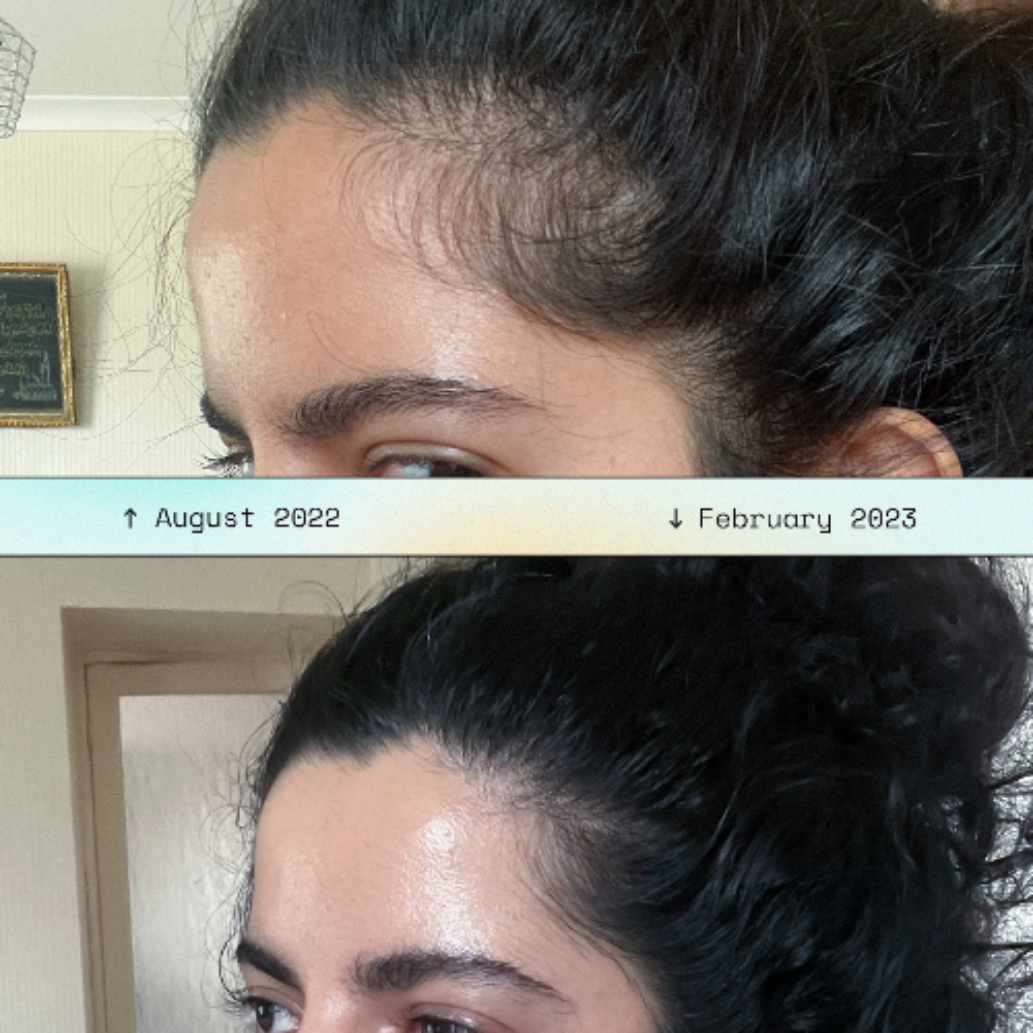 FestiveHeaven Hair Growth Massager