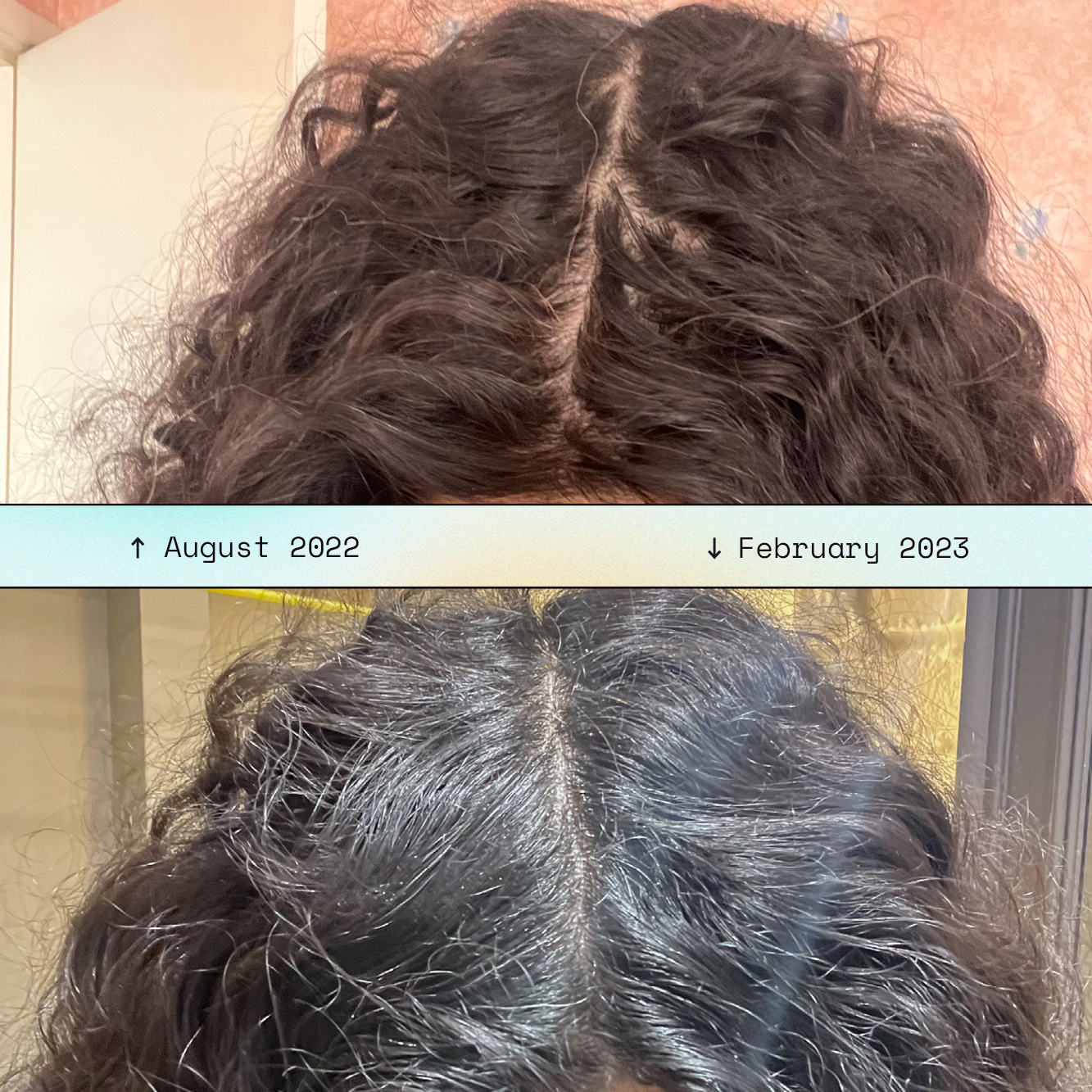 FestiveHeaven Hair Growth Massager